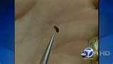 Bed Bugs Dangerous images