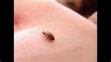 images of Bed Bugs Enemies