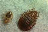 photos of Bed Bugs Associated Press