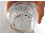 Bed Bugs Associated Press photos