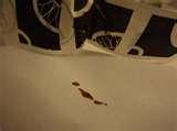 Bed Bugs Chicago Hotel images