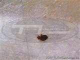 Bed Bugs Video Clip images
