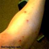 Bed Bugs Video Clip pictures