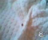 Bed Bugs Charleston Sc