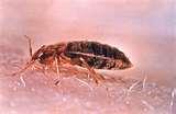 Bed Bugs Good Morning America pictures