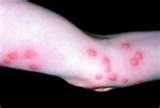 How Fast Can Bed Bugs Multiply