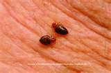 Are Bed Bugs Flat photos