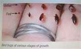 Are Bed Bugs Flat photos