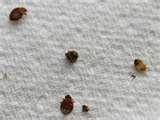 pictures of Bed Bugs Kids