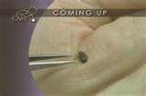 Bed Bugs Oc Md images