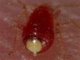 Bed Bugs Ny Hotels pictures
