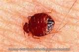 New York Bed Bugs Epidemic pictures