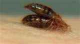 Bed Bugs Abc News photos