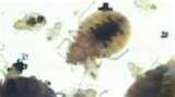 images of Bed Bugs Abc News