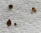 Bed Bugs Abercrombie  Fitch pictures