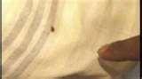 pictures of Bed Bugs Tv Program
