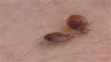 Bed Bugs Tv Program