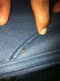 images of Bed Bugs Is San Francisco