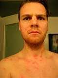 Bed Bugs Good images