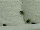 pictures of Bed Bugs Louisiana