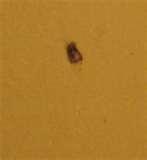 photos of Bed Bugs Years Ago