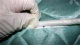 photos of Bed Bugs Wgn