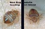images of Can Bed Bugs Carry Mrsa