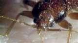 images of Can Bed Bugs Carry Mrsa