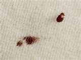 photos of Bed Bugs Naples Fl