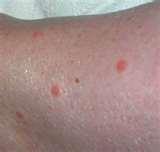 How Do Bed Bugs Know Where You Are images