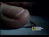 images of Bed Bugs Risk