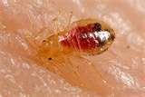 Bed Bugs Psychological Trauma photos