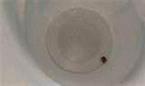 Bed Bugs In Billings Mt pictures