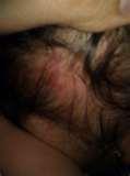 Bed Bugs El Paso photos