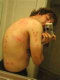 images of How Do Bed Bugs Feed