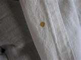Bed Bugs Blood Stains photos