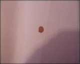 Bed Bugs Blood Stains images