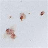 images of Bed Bugs Blood Stains