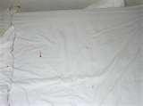 Bed Bugs Blood Stains images