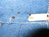 photos of Bed Bugs Assistance