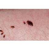 Pictures Of Bed Bugs Rashes pictures