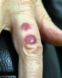 Bed Bugs Tv Commercial photos