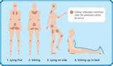 Bed Bugs Wounds pictures
