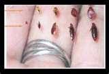 Bed Bugs Images Actual Size pictures