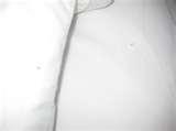 images of Bed Bugs Iowa Hotels