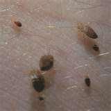 photos of Bed Bugs Ajax