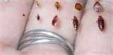 photos of Bed Bugs Jump Do