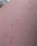 Bed Bugs Yiddish pictures