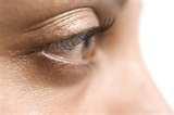 Bed Bugs Eat Dead Skin pictures