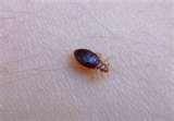 Bed Bugs Stories images